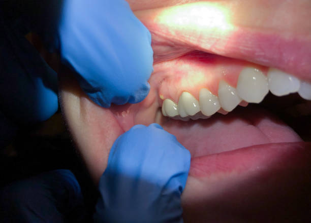 Best Broken or Chipped Tooth Repair in Paradise Valley, AZ
